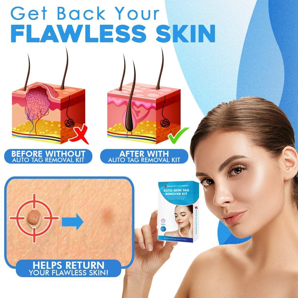 Z-Skin™ Skin Tag Removal Kit